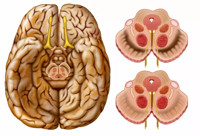 Illustrasjon av det senteret i midthjernen som utløser dopamin. Dopamin gjør oss oppstemte og kan forsterke trangen til hasj, spill, sukker, kaffe, alkohol og alt mulig annet, hvis hjernen før har opplevd at det føles bra. (Foto: ilusmedical / Shutterstock / NTB scanpix)