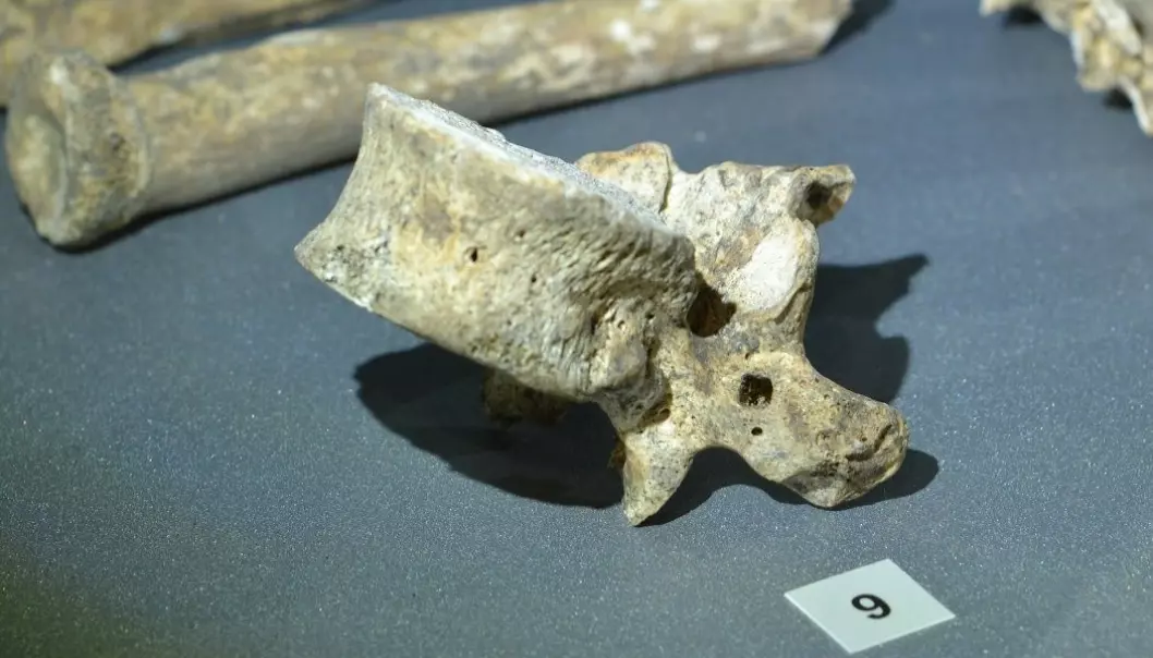 Dette er en bit av ryggsøylen til et menneske som levde for 900 år siden. Men hvorfor er det et firkantet hull i den? (Foto: Sean Dexter Denham)
