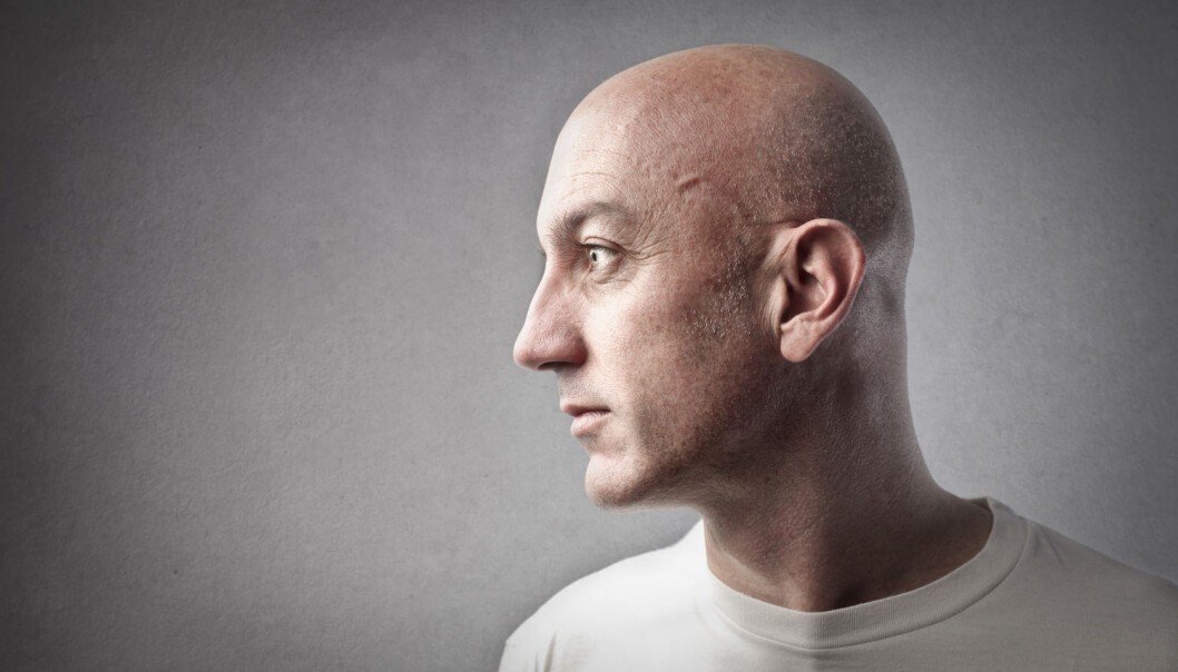 Personer som har fått cellegift, kan senere ha problemer med å huske eller konsentrere seg. Det dokumenterer en ny studie blant 64 menn med testikkelkreft. (Illustrasjonsfoto: Ollyy / Shutterstock / NTB scanpix) Personer som har fått cellegift, kan senere ha problemer med å huske eller konsentrere seg. Det dokumenterer en ny studie blant 64 menn med testikkelkreft. (Illustrasjonsfoto: Ollyy / Shutterstock / NTB scanpix)