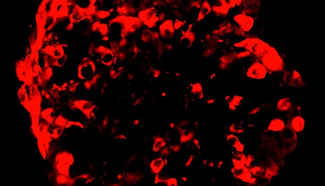De røde cellene har tidligere vært norske diabetespasienters hudceller. Nå skiller de ut insulin, som du kan se som de mørkegrå områdene på bildet. (Foto: Vethe m flere, Scientific Reports) De røde cellene har tidligere vært norske diabetespasienters hudceller. Nå skiller de ut insulin, som du kan se som de mørkegrå områdene på bildet. (Foto: Vethe m flere, Scientific Reports)