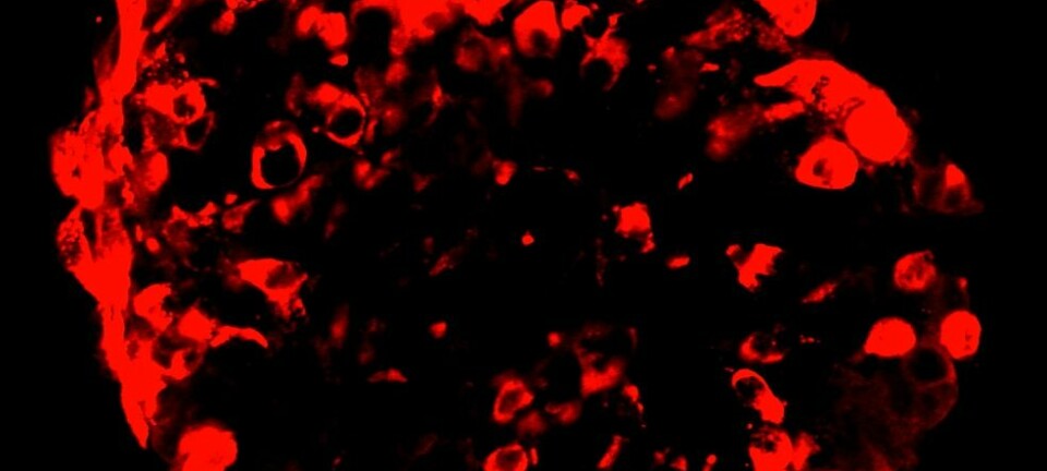 De røde cellene har tidligere vært norske diabetespasienters hudceller. Nå skiller de ut insulin, som du kan se som de mørkegrå områdene på bildet.  (Foto: Vethe m flere, Scientific Reports)