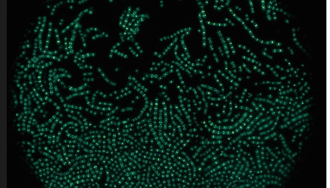 Celledeling er ein føresetnad for liv, i alt frå eincella bakteriar til fleircella organismar, som menneske. Her ser vi pneumokokkane med fluorescerande celledelingsprotein. (Foto: Renske van Raaphorst) Celledeling er ein føresetnad for liv, i alt frå eincella bakteriar til fleircella organismar, som menneske. Her ser vi pneumokokkane med fluorescerande celledelingsprotein. (Foto: Renske van Raaphorst)