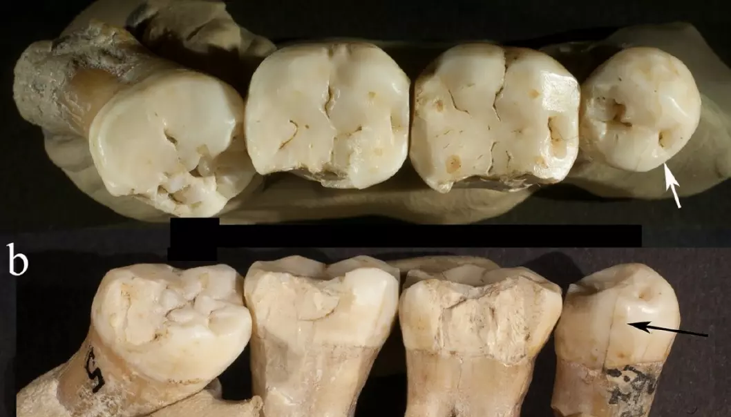 Denne neandertaleren prøvde å fikse tennene sine