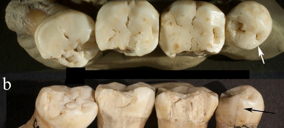 Disse tennene satt i munnen på en neandertaler for 130 000 år siden. Bare tennene er igjen. (Bilde: Frayer et al./CC BY NC ND)