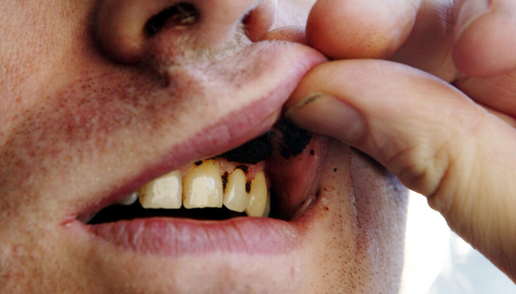 Snus er forbudt å selge i alle europeiske land, med bare to unntak. (Foto: Cornelius Poppe, Scanpix) Snus er forbudt å selge i alle europeiske land, med bare to unntak. (Foto: Cornelius Poppe, Scanpix)