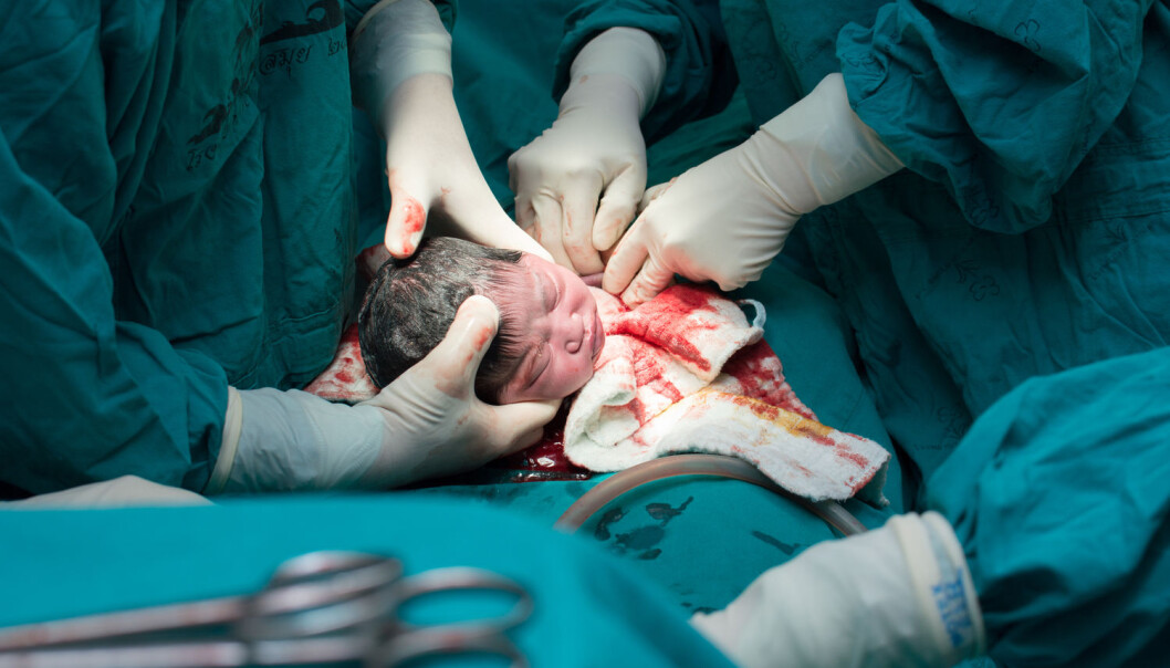 Noen kvinner foretrekker en operasjon framfor at babyen kommer ut på vanlig vis. (Foto: Shutterstock/NTB scanpix) Noen kvinner foretrekker en operasjon framfor at babyen kommer ut på vanlig vis. (Foto: Shutterstock/NTB scanpix)