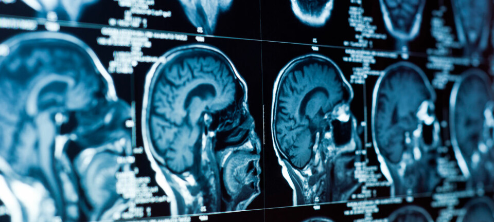 Hvordan påvirke hjerneceller dypt nede i hjernen, uten å måtte åpne hodeskallen? (Foto: Shutterstock/NTB Scanpix)