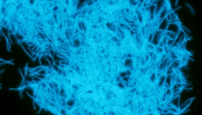 Disse bakteriene kalles "Methanobacterium". De produserer metan og ble funnet 2 kilometer under havbunnen i Stillehavet utenfor Japan. (Bilde: Hiroyuki Imachi, Japan Agency for Marine-Earth Science and Technology). Disse bakteriene kalles "Methanobacterium". De produserer metan og ble funnet 2 kilometer under havbunnen i Stillehavet utenfor Japan. (Bilde: Hiroyuki Imachi, Japan Agency for Marine-Earth Science and Technology).