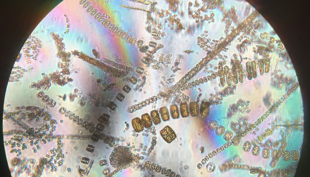 Når planteplankton blomstrer utenfor Svalbard, er det så mange av dem at du kan få med millioner av de encellede organismene bare ved å dyppe en bøtte i havet. Slik ser forskernes prøver ut gjennom mikroskopet. (Foto: Eivind Torgersen) Når planteplankton blomstrer utenfor Svalbard, er det så mange av dem at du kan få med millioner av de encellede organismene bare ved å dyppe en bøtte i havet. Slik ser forskernes prøver ut gjennom mikroskopet. (Foto: Eivind Torgersen)