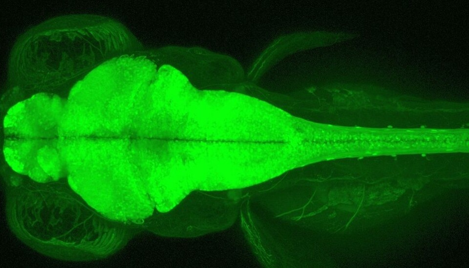 Siden fiskelarvene er gjennomsiktige er det mulig å undersøke hjernefunksjonen til sebrafisk uten noen form for inngrep og helt uten å påføre dem smerte. (Foto: Kavli Institute for Systems Neuroscience)