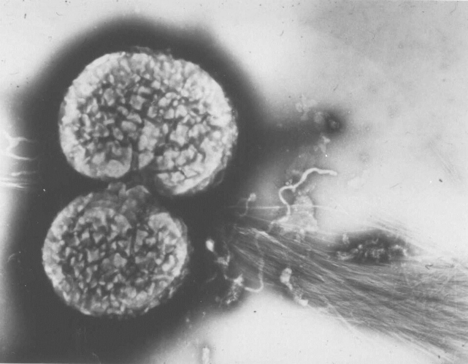 Elektronmikroskopisk bilde av to gonokk-celler med «hestehale» som gjør at de fester seg på slimhinnen og til hverandre. Foto: Tone Tønjum.