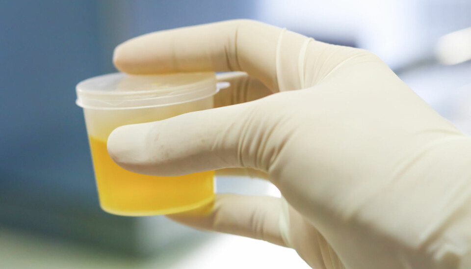 Forskere ved Universitetet i Oslo forsøker å finne fram til en «merkelapp» som bare finnes i urinen hos mennesker med blærekreft, og som kan identifiseres på en forholdsvis enkel måte. (Illustrasjonsfoto: BENCHAMAT / Shutterstock / NTB scanpix)