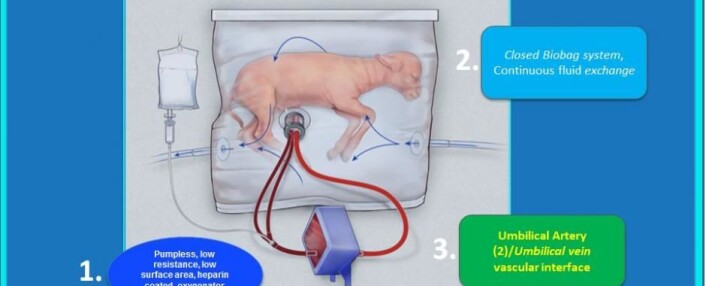 Illustrasjon av den kunstige livmoren som forskere har holdt et lam i live med i 28 dager. Lammet utviklet seg som det skulle i den kunstige livmoren. (Foto: (Illustrasjon: Children's Hospital of Philadelphia)) Illustrasjon av den kunstige livmoren som forskere har holdt et lam i live med i 28 dager. Lammet utviklet seg som det skulle i den kunstige livmoren. (Foto: (Illustrasjon: Children's Hospital of Philadelphia))