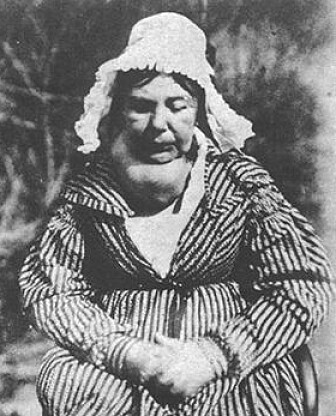 Det som regnes som det første fotografiet tatt til medisinsk bruk viser en skotsk kvinne med struma, 1847. (Foto: Hill & Adamson) Det som regnes som det første fotografiet tatt til medisinsk bruk viser en skotsk kvinne med struma, 1847. (Foto: Hill & Adamson)