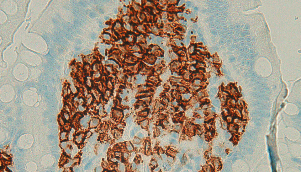 Det brune på dette bildet er plasmaceller som er tilsatt fargestoff. Plasmaceller er en del av immunforsvaret vårt og skiller ut antistoffer mot lumske bakterier. De finnes også i tarmen og nå viser ny forskning at de kan leve der i flere år. Det gir håp for nye vaksiner.  (Foto: Ole J.B. Landsverk)