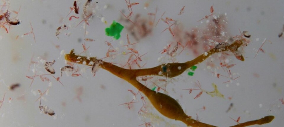 Plankton og mikroplast i salig blanding. (Foto: Anna Deniaud, Tara Expeditions Foundation)