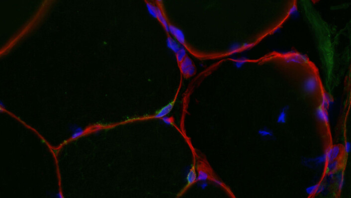 Bildet viser et tverrsnitt av en muskelbiopsi som er farget med spesielle markører. Ytterkanten (cellemembranen) av muskelcellene er farget rødt og cellekjernene vises med blått. For at flere cellekjerner skal tilføres, må satellittceller smelte sammen med muskelcellen. To satellittceller synlige midt i bildet, og er markert med en grønn ring rundt to cellekjerner (markert med blått). Foto: Kristoffer T. Cumming Bildet viser et tverrsnitt av en muskelbiopsi som er farget med spesielle markører. Ytterkanten (cellemembranen) av muskelcellene er farget rødt og cellekjernene vises med blått. For at flere cellekjerner skal tilføres, må satellittceller smelte sammen med muskelcellen. To satellittceller synlige midt i bildet, og er markert med en grønn ring rundt to cellekjerner (markert med blått). Foto: Kristoffer T. Cumming