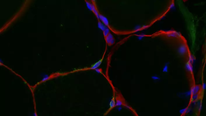 Bildet viser et tverrsnitt av en muskelbiopsi som er farget med spesielle markører. Ytterkanten (cellemembranen) av muskelcellene er farget rødt og cellekjernene vises med blått. For at flere cellekjerner skal tilføres, må satellittceller smelte sammen med muskelcellen. To satellittceller synlige midt i bildet, og er markert med en grønn ring rundt to cellekjerner (markert med blått). Foto: Kristoffer T. Cumming