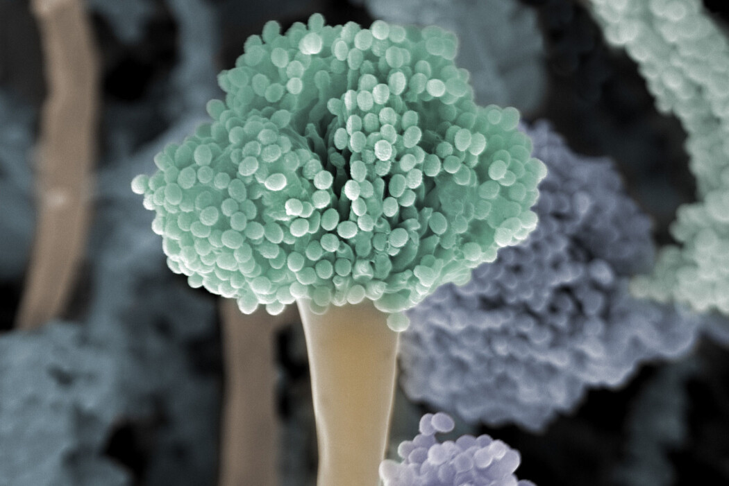 Muggsoppen Aspergillus fumigatus kan føre til dødelig sykdom. De siste årene har den utviklet stadig høyere resistens mot legemidler som brukes til å behandle soppinfeksjoner hos mennesker og dyr. (Foto: Jannicke Wiik-Nielsen / Veterinærinstituttet / NTB scanpix) Muggsoppen Aspergillus fumigatus kan føre til dødelig sykdom. De siste årene har den utviklet stadig høyere resistens mot legemidler som brukes til å behandle soppinfeksjoner hos mennesker og dyr. (Foto: Jannicke Wiik-Nielsen / Veterinærinstituttet / NTB scanpix)