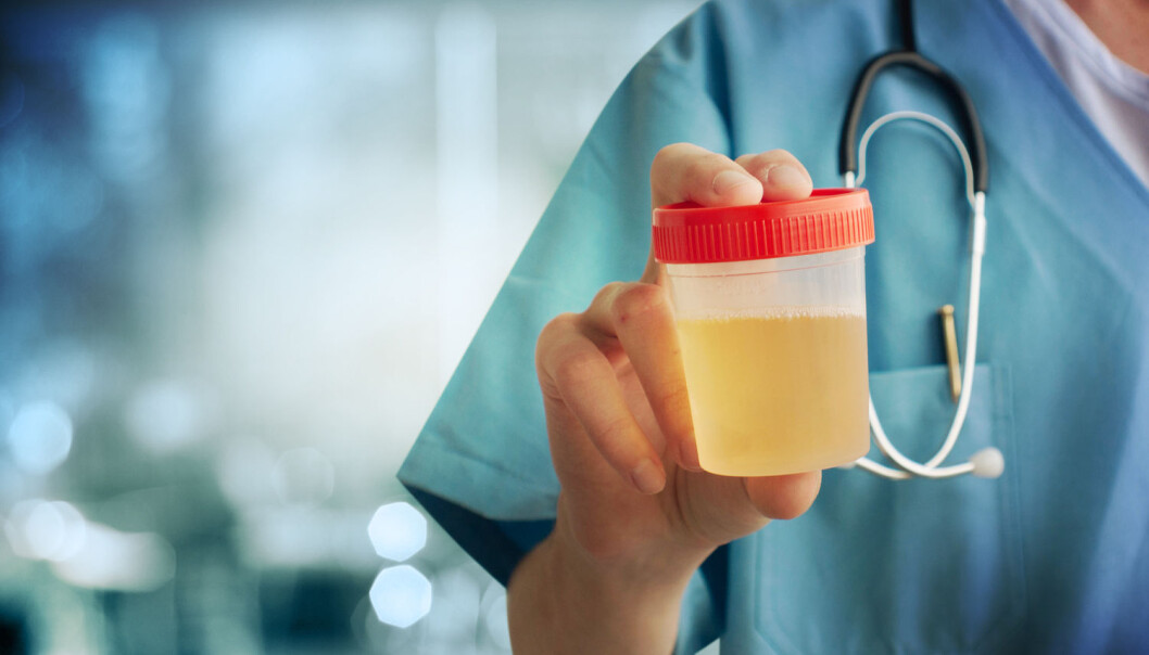 Danske forskere håper at en ny urintest for prostatakreft kan være klar til bruk ved sykehusene innen fem år. (Foto: Guschenkova / Shutterstock / NTB scanpix) Danske forskere håper at en ny urintest for prostatakreft kan være klar til bruk ved sykehusene innen fem år. (Foto: Guschenkova / Shutterstock / NTB scanpix)