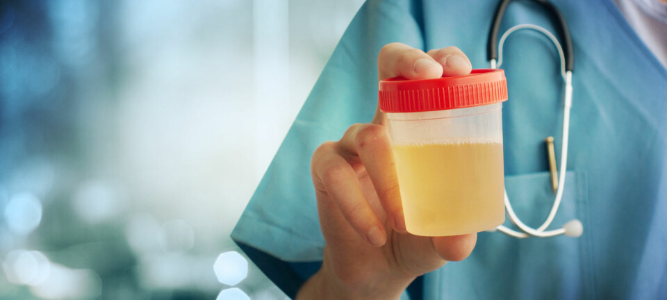 Danske forskere håper at en ny urintest for prostatakreft kan være klar til bruk ved sykehusene innen fem år. (Foto: Guschenkova / Shutterstock / NTB scanpix)