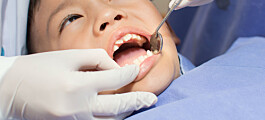 Vil finne den beste metoden mot hull i tennene