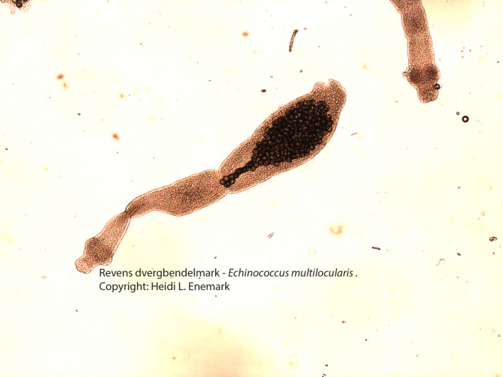 Mikroskopi av revens dverg¬bendelorm. Ormen er cirka 5 millimeter lang. Det bakerste leddet inneholder tallrike parasittegg. (Foto: Veterinærinstituttet) Mikroskopi av revens dverg¬bendelorm. Ormen er cirka 5 millimeter lang. Det bakerste leddet inneholder tallrike parasittegg. (Foto: Veterinærinstituttet)