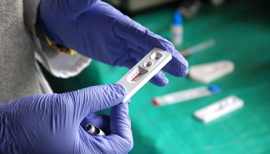 Flere menn som har sex med menn tester seg nå for hiv hjemme, noe som gjør at flere begynner tidligere med antivirus-behandling. Det igjen forebygger smitte, mener Folkehelseinstituttet. (Foto: Franco Volpato, Shutterstock, NTB scanpix) Flere menn som har sex med menn tester seg nå for hiv hjemme, noe som gjør at flere begynner tidligere med antivirus-behandling. Det igjen forebygger smitte, mener Folkehelseinstituttet. (Foto: Franco Volpato, Shutterstock, NTB scanpix)