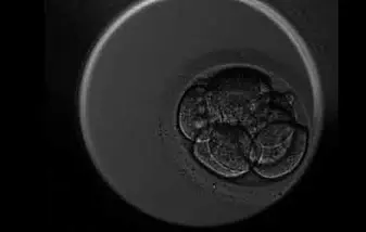 Se hvordan en eggcelle deler seg de første dagene etter befruktning