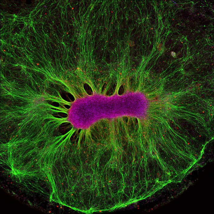 Denne stamcellen har ligget i gele i bare to uker og er godt i gang med å bygge nervetråder. Hele bildet er fem millimeter bredt. (Foto: Collin Edington og Iris Lee, Koch Institute ved MIT) Denne stamcellen har ligget i gele i bare to uker og er godt i gang med å bygge nervetråder. Hele bildet er fem millimeter bredt. (Foto: Collin Edington og Iris Lee, Koch Institute ved MIT)
