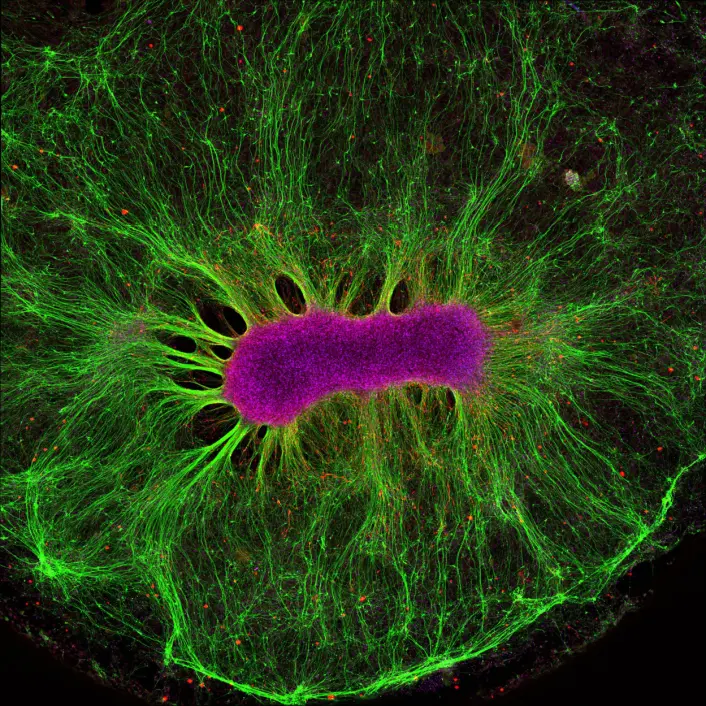 Denne stamcellen har ligget i gele i bare to uker og er godt i gang med å bygge nervetråder. Hele bildet er fem millimeter bredt. (Foto: Collin Edington og Iris Lee, Koch Institute ved MIT) Denne stamcellen har ligget i gele i bare to uker og er godt i gang med å bygge nervetråder. Hele bildet er fem millimeter bredt. (Foto: Collin Edington og Iris Lee, Koch Institute ved MIT)