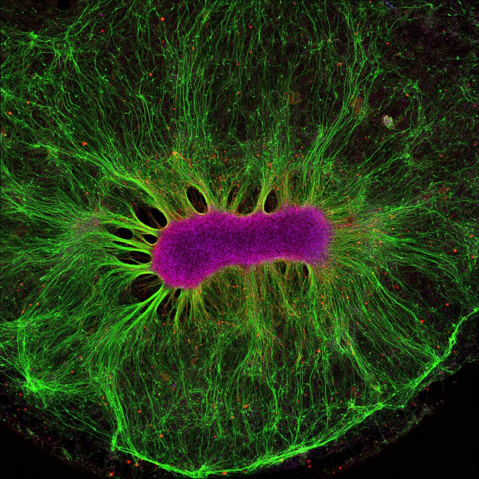 Denne stamcellen har ligget i gele i bare to uker og er godt i gang med å bygge nervetråder. Hele bildet er fem millimeter bredt. (Foto: Collin Edington og Iris Lee, Koch Institute ved MIT)