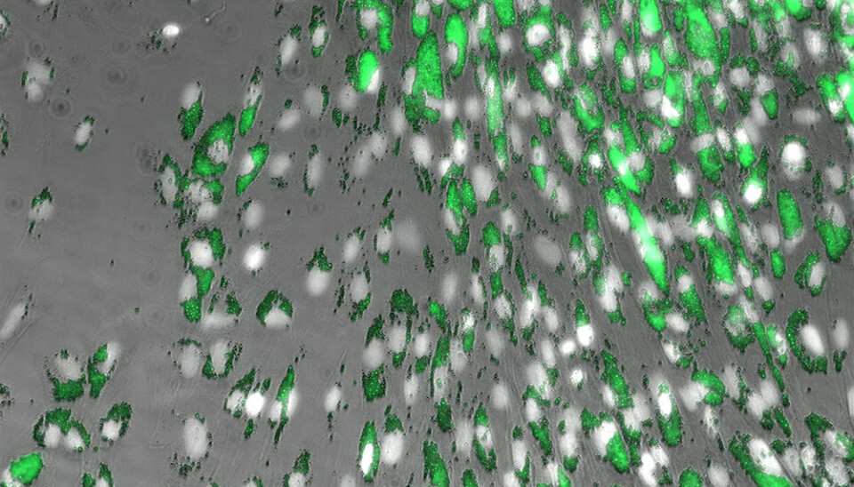 Etter 7 dager kan det tydelig ses at makrofager fra Atlantisk laks tar opp de små plastpartiklene (1-5 µM, grønne). (Foto: Anita Solhaug, Veterinærinstituttet)