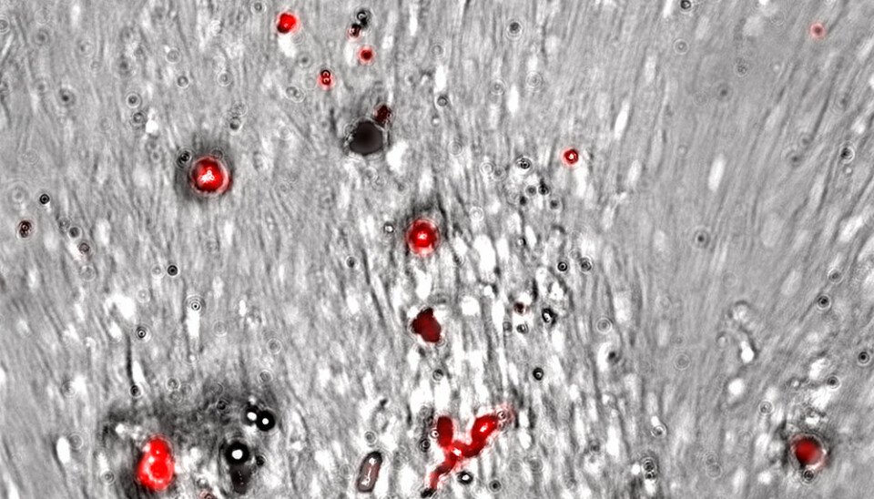 De større plastpartiklene (10-22 µm, røde) er for store til å tas opp, men makrofagene forsøker allikevel å fjerne dem antagelig ved å skille ut aktive stoffer som bryter dem ned. (Foto: Anita Solhaug)