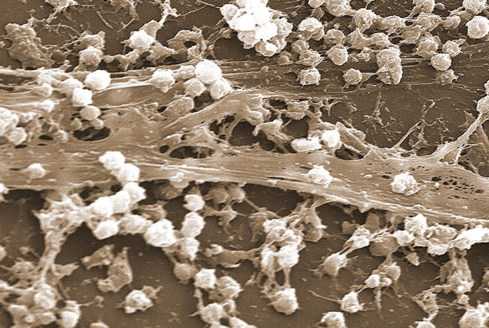 Biofilm dannet av gule stafylokokker, vanlig ved sykehusinfeksjoner, på et innlagt kateter. (Foto: (Mikroskopi: United States Department of Health and Human Services.)) Biofilm dannet av gule stafylokokker, vanlig ved sykehusinfeksjoner, på et innlagt kateter. (Foto: (Mikroskopi: United States Department of Health and Human Services.))