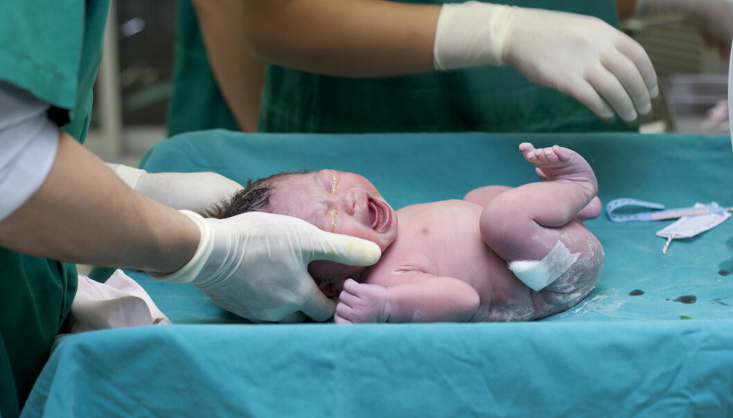 Hode og kropp blir trykket sammen når det lille barnet passerer gjennom fødselskanalen. En fødsel er en hard opplevelse, men er det traumatisk?  (Foto: passpun / Shutterstock / NTB scanpix)