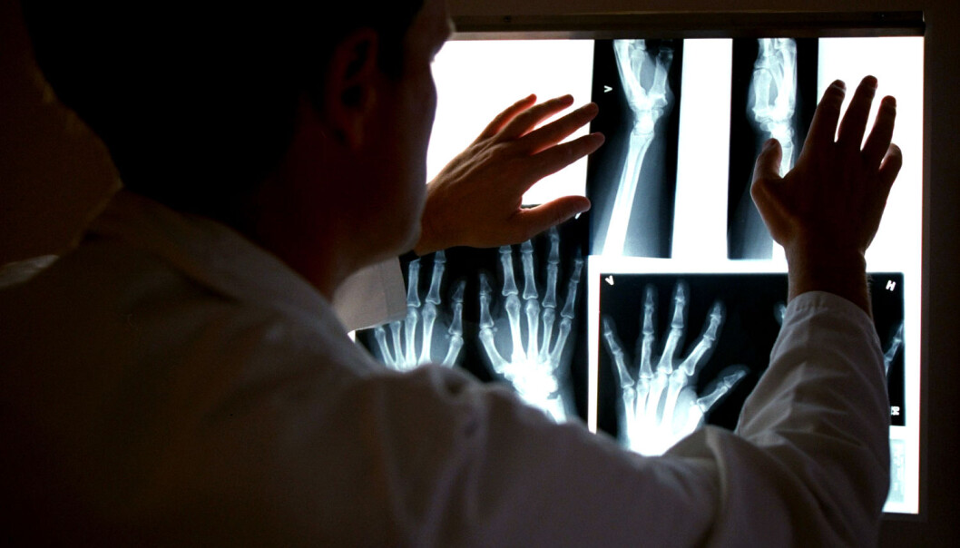 En norsk forsker har utviklet en ny type medisin mot leddgikt. Den blokkerer et overordnet kjønnshormon som kan spille en rolle i utviklingen av sykdommen. Bildet viser røntgenbilder av en pasient, ved revmatologisk poliklinikk, Diakonhjemmet. (Foto: Aftenposten) En norsk forsker har utviklet en ny type medisin mot leddgikt. Den blokkerer et overordnet kjønnshormon som kan spille en rolle i utviklingen av sykdommen. Bildet viser røntgenbilder av en pasient, ved revmatologisk poliklinikk, Diakonhjemmet. (Foto: Aftenposten)