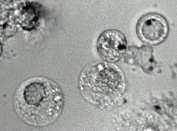 Amøbar infiserte med legionella. (Foto: Anne Vatland Krøvel) Amøbar infiserte med legionella. (Foto: Anne Vatland Krøvel)