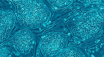 Nærmere stamcelleterapi mot alvorlige sykdommer