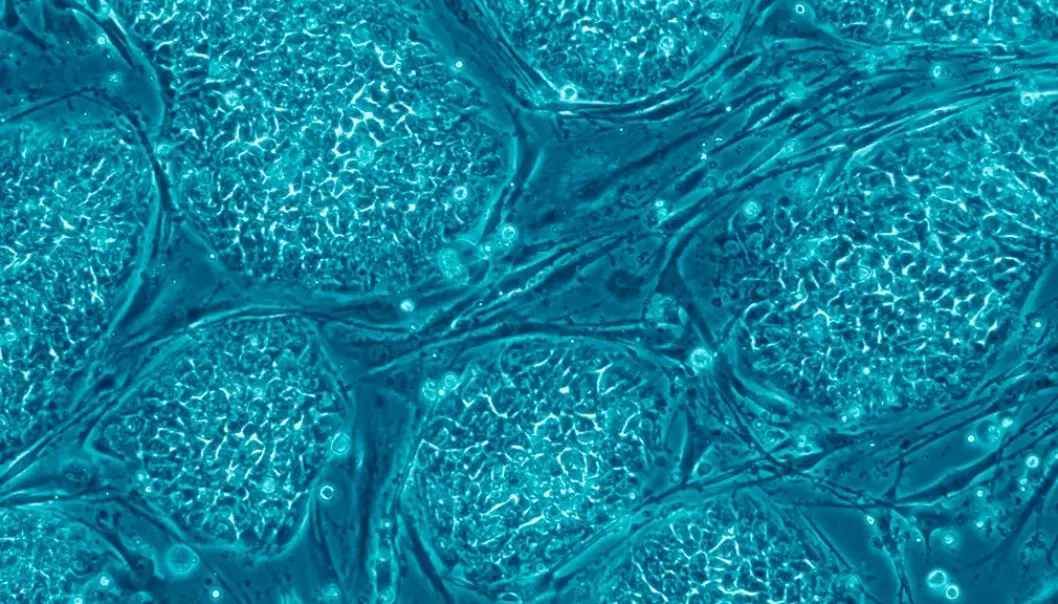 Intens forskning pågår for å finne alternative kilder til stamceller til terapeutisk bruk.  (Foto: Nissim Benvenisty/Wikimedia commons)