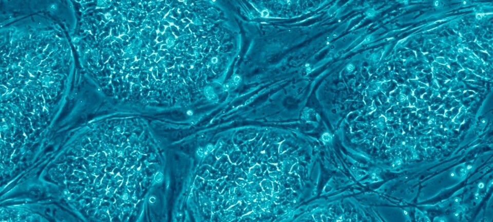 Intens forskning pågår for å finne alternative kilder til stamceller til terapeutisk bruk.  (Foto: Nissim Benvenisty/Wikimedia commons)