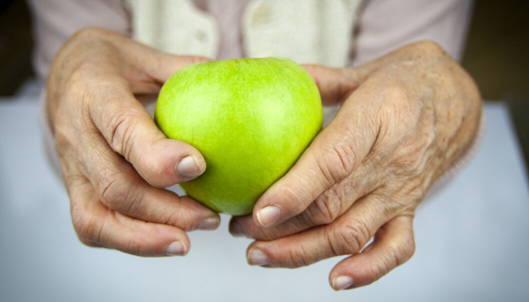 En bestemt bakterie er funnet hos mange personer med leddgikt og tannkjøttsykdom. Færre friske personer har den. (Foto: Shutterstock/NTB Scanpix) En bestemt bakterie er funnet hos mange personer med leddgikt og tannkjøttsykdom. Færre friske personer har den. (Foto: Shutterstock/NTB Scanpix)