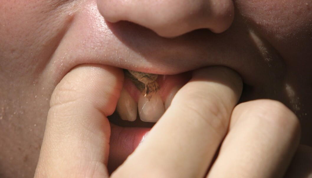 Snus ser ut til å hjelpe røykere med å slutte. Men denne funksjonen som snus har nå, vil naturlig nok bli mindre viktig etterhvert som røykerne blir færre, spår forskerne. (Foto: Jarl Fr. Erichsen / NTB scanpix) Snus ser ut til å hjelpe røykere med å slutte. Men denne funksjonen som snus har nå, vil naturlig nok bli mindre viktig etterhvert som røykerne blir færre, spår forskerne. (Foto: Jarl Fr. Erichsen / NTB scanpix)