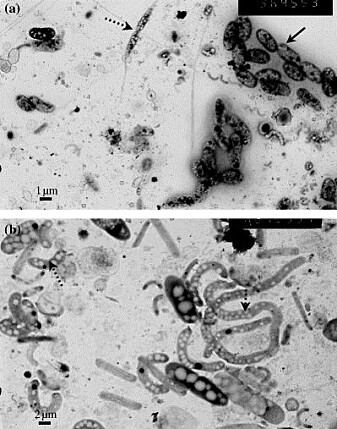 Disse knøttsmå bakteriene er nesten umettelige. (Foto: T. Frede Thingstad mfl. «Use of non‐limiting substrates to increase size; a generic strategy to simultaneously optimize uptake and minimize predation in pelagic osmotrophs?» <i>Ecology Letters</i>, 2005 ) Disse knøttsmå bakteriene er nesten umettelige. (Foto: T. Frede Thingstad mfl. «Use of non‐limiting substrates to increase size; a generic strategy to simultaneously optimize uptake and minimize predation in pelagic osmotrophs?» <i>Ecology Letters</i>, 2005 )