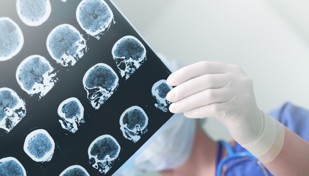 Danske forskere avslører hvordan hjernen kan forsvare seg mot virusangrep. (Illustrasjonsfoto: sfam_photo / Shutterstock / NTB scanpix) Danske forskere avslører hvordan hjernen kan forsvare seg mot virusangrep. (Illustrasjonsfoto: sfam_photo / Shutterstock / NTB scanpix)