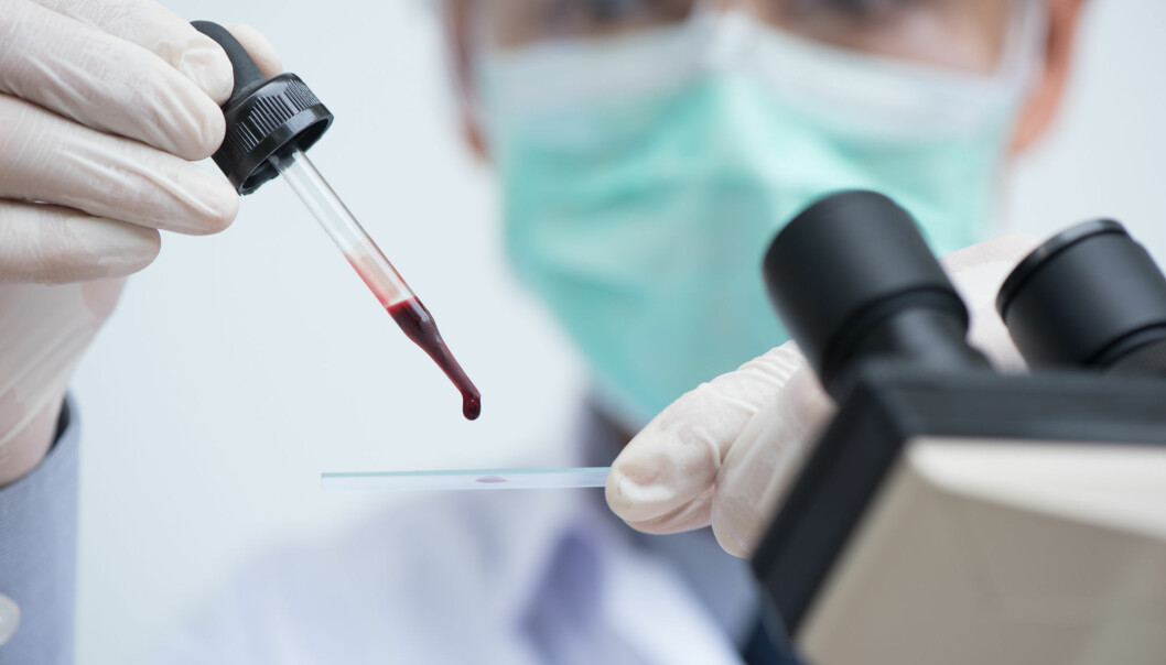 Forskere hevder de er nærmere en blodprøve for å påvise fibromyalgi enn noen gang. (Illustrasjonsbilde: TippaPatt, Shutterstock, NTB scanpix)