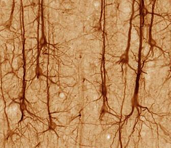 Illustrasjonsbilde: Dette er hjerneceller, kalt nevroner i cerebral cortex. (Bilde: UC Regents Davis/CC BY 3.0) Illustrasjonsbilde: Dette er hjerneceller, kalt nevroner i cerebral cortex. (Bilde: UC Regents Davis/CC BY 3.0)