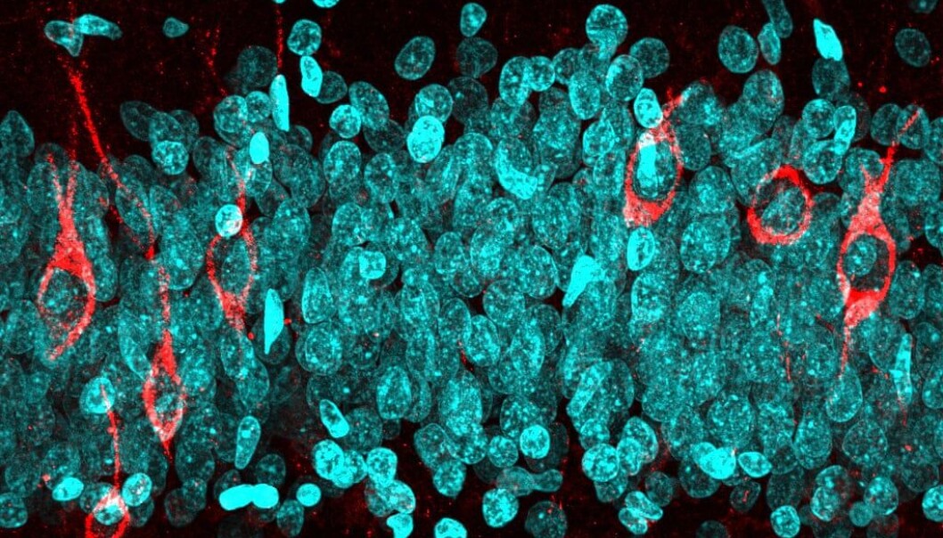 Mikroskop-bilde av hjernen til en 68 år gammel donor. Hjernen var frisk da han døde. På bildet er nyfødte hjerneceller markert i rødt, mens eldre hjerneceller er i blått. Foto: CSIC via Nature Mikroskop-bilde av hjernen til en 68 år gammel donor. Hjernen var frisk da han døde. På bildet er nyfødte hjerneceller markert i rødt, mens eldre hjerneceller er i blått. Foto: CSIC via Nature