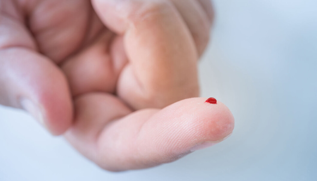 Hvorfor er blodet vårt egentlig rødt? Det kunne vel like godt være grønt – eller hva? Vi har undersøkt saken nærmere. (Illustrasjonsfoto: NatchaS / Shutterstock / NTB scanpix) Hvorfor er blodet vårt egentlig rødt? Det kunne vel like godt være grønt – eller hva? Vi har undersøkt saken nærmere. (Illustrasjonsfoto: NatchaS / Shutterstock / NTB scanpix)