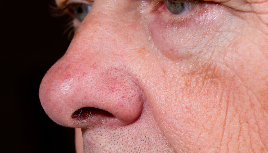 (Foto: Steve Heap, Shutterstock, NTB scanpix) (Foto: Steve Heap, Shutterstock, NTB scanpix)